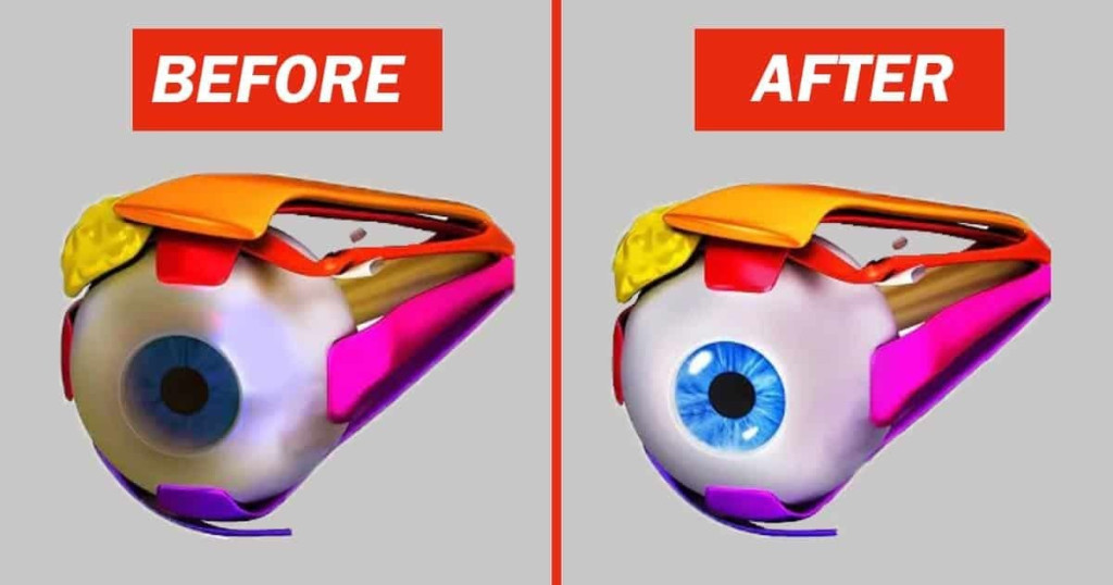 10 Great Exercises to Improve Your Eyesight