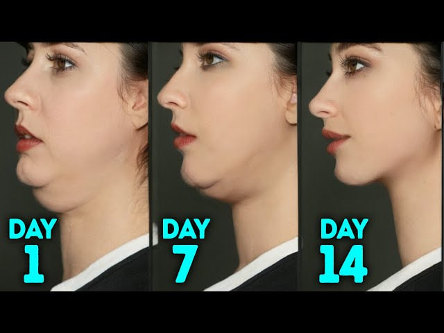 DOUBLE CHIN FAT & FACE LIFT | BEST FACIAL EXERCISES